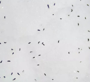 How To Get Rid Of Snow Fleas – Also Known As Collembola, Springtails ...